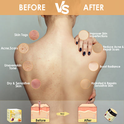 Cofutic Skin Care Cream Gentle Hydrating Smooth Delicate And Moisturizing Skin Daily Nourishing Body Cream